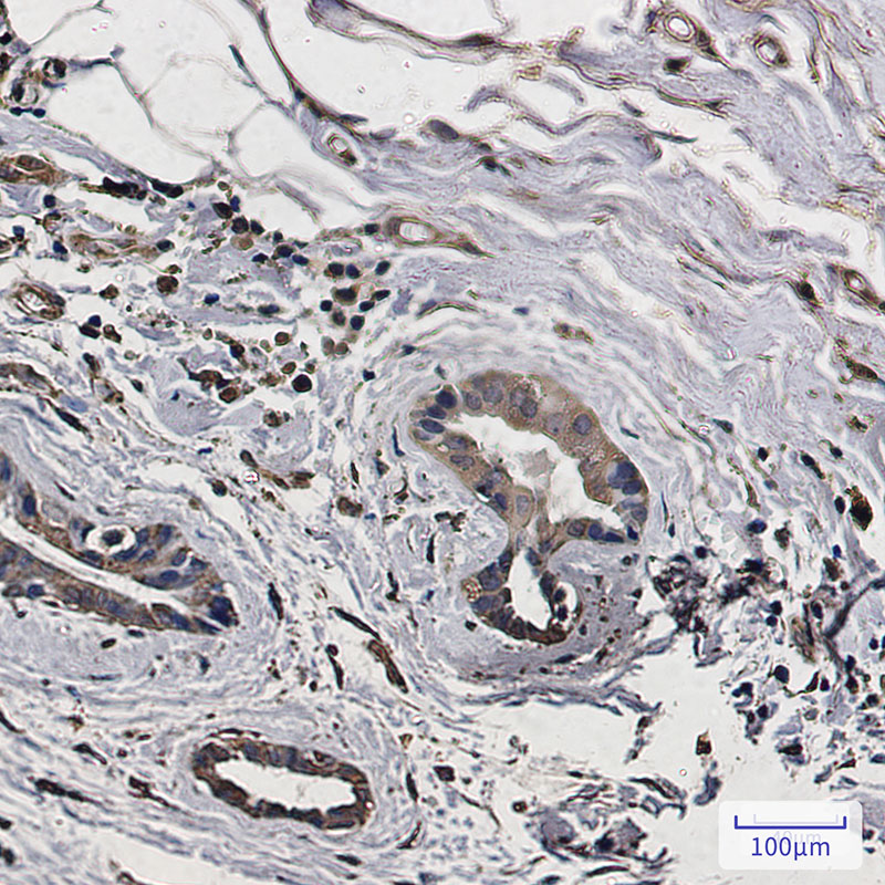 LC3A Rabbit mAb